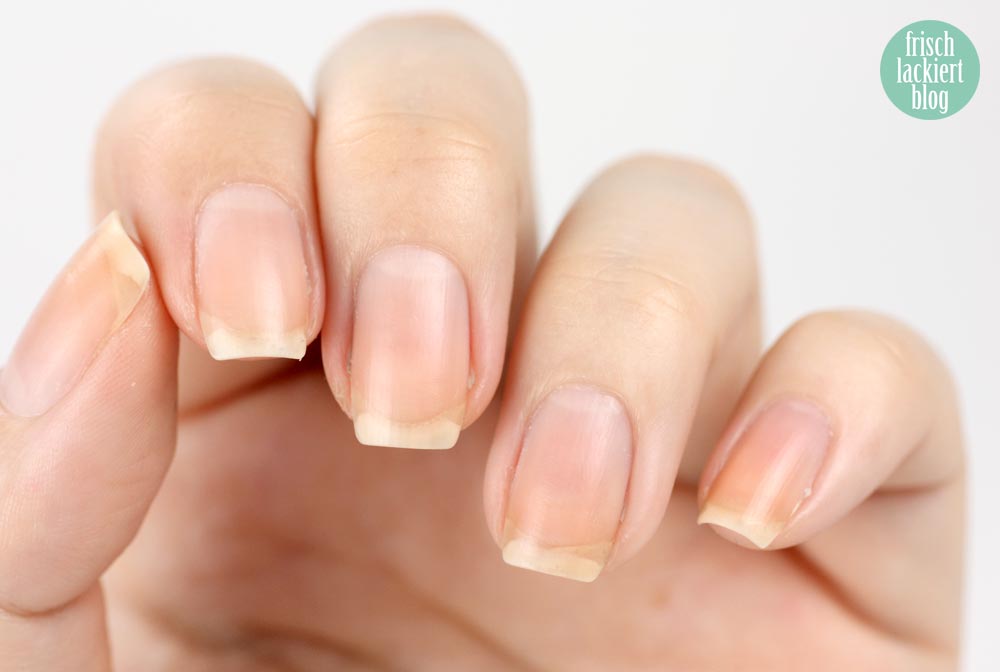 Nagelpflege Schritt für Schritt – Tipps – Hilfe – by frischlackiert