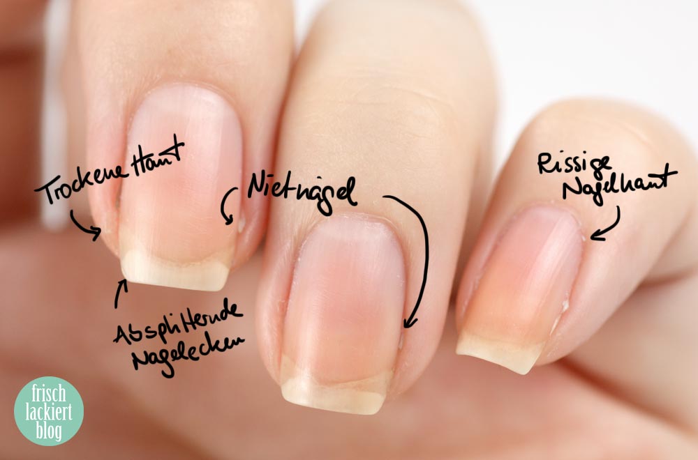 Nagelpflege Schritt für Schritt – Tipps – Hilfe – by frischlackiert