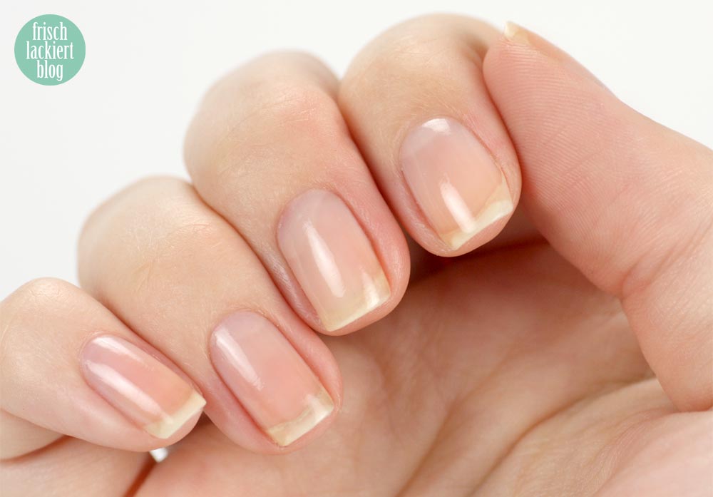 Nagelpflege Schritt für Schritt – Tipps – Hilfe – by frischlackiert