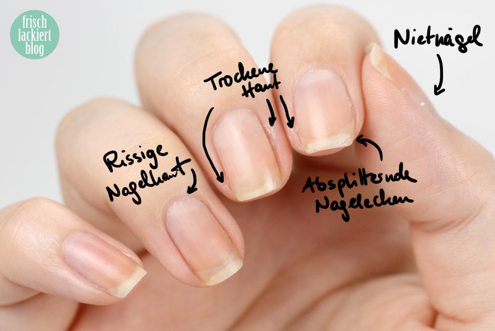 Nagelpflege Schritt für Schritt – Tipps – Hilfe – by frischlackiert
