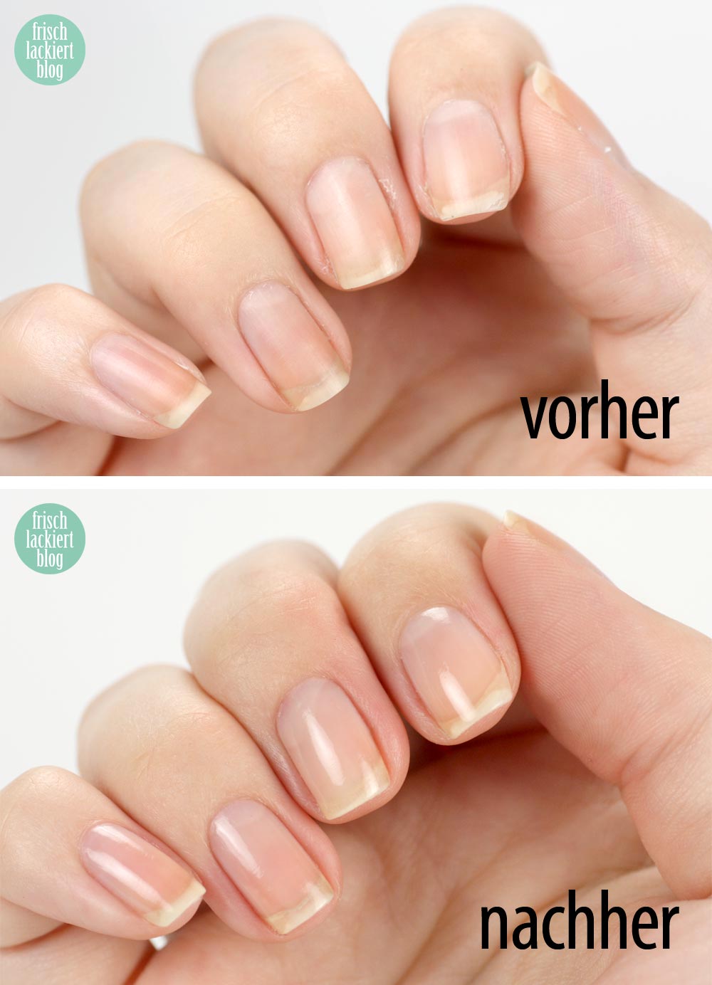 Nagelpflege Schritt für Schritt – Tipps – Hilfe – by frischlackiert