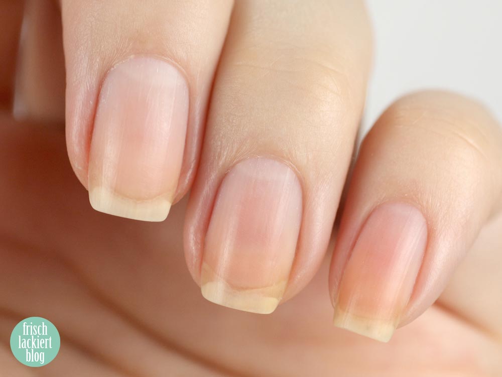 Nagelpflege Schritt für Schritt – Tipps – Hilfe – by frischlackiert
