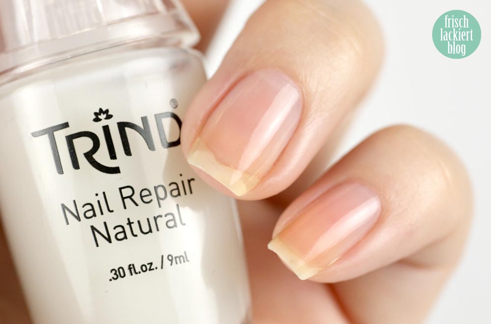 Nagelpflege Schritt für Schritt – Tipps – Hilfe – by frischlackiert