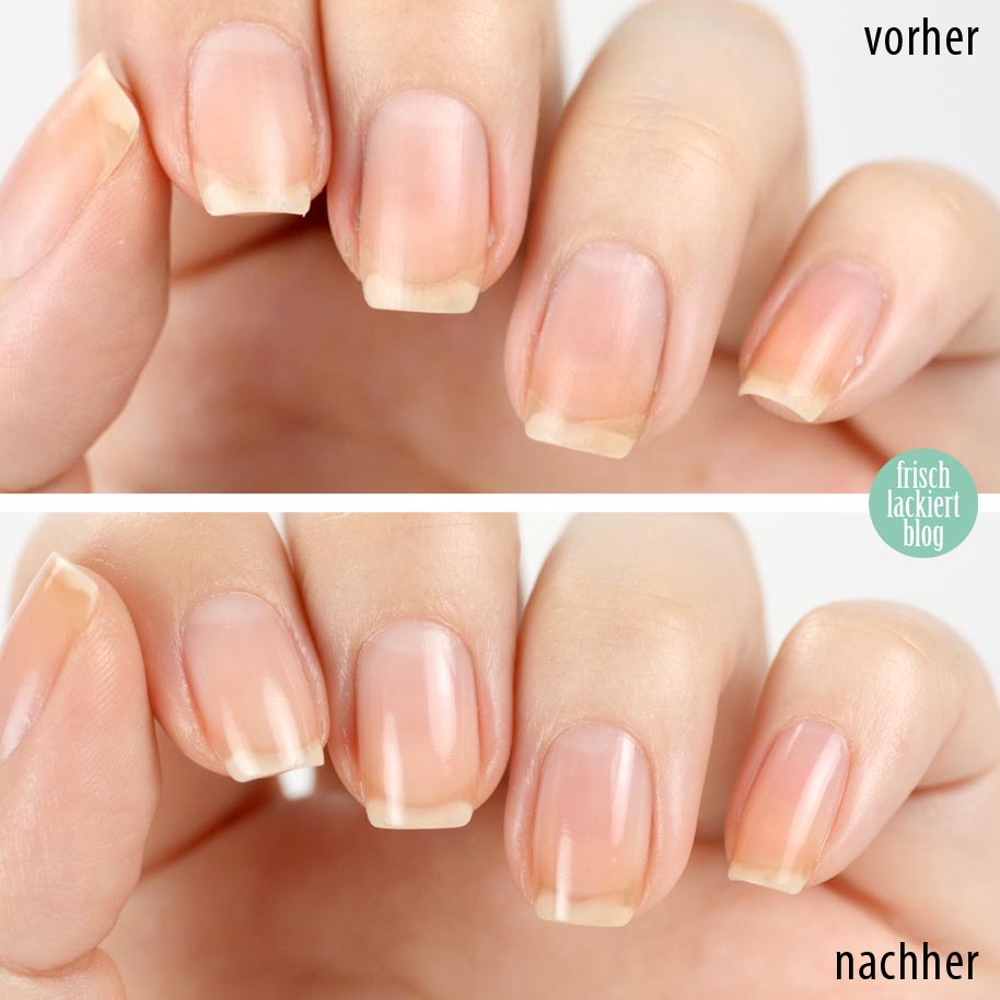 Nagelpflege Schritt für Schritt – Tipps – Hilfe – by frischlackiert
