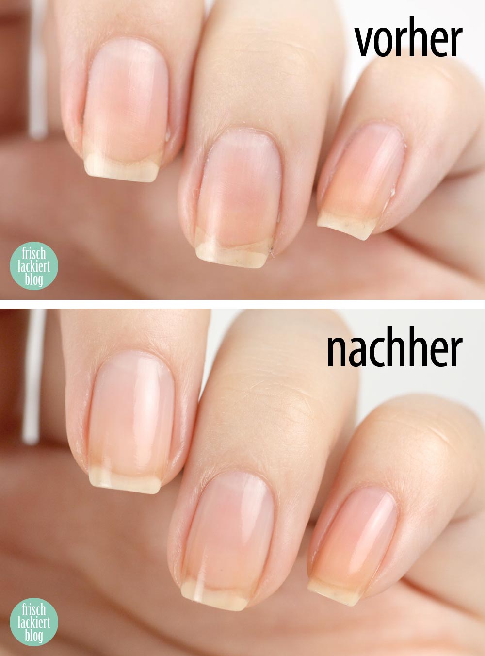 Nagelpflege Schritt für Schritt – Tipps – Hilfe – by frischlackiert